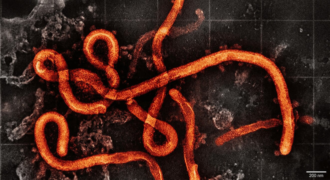 Microscopic view of Ebola virus string cells and orange particles on high‑contrast background &ndash; virology research, infectious disease, medical illustration, pathogen visualization, scientific, labs