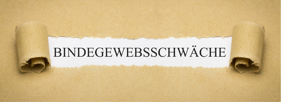 Bindegewebsschwäche