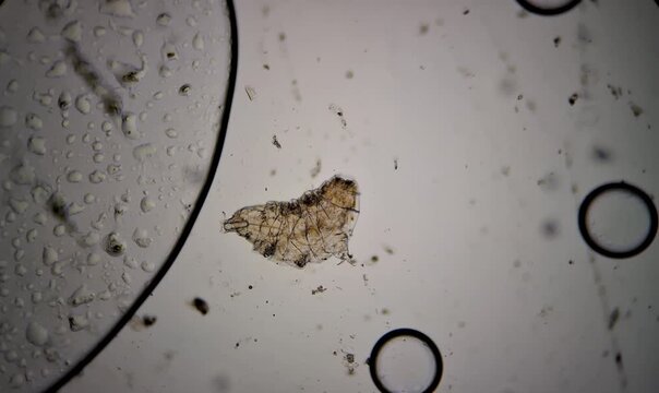 microorganisms, tardigrades under the microscope