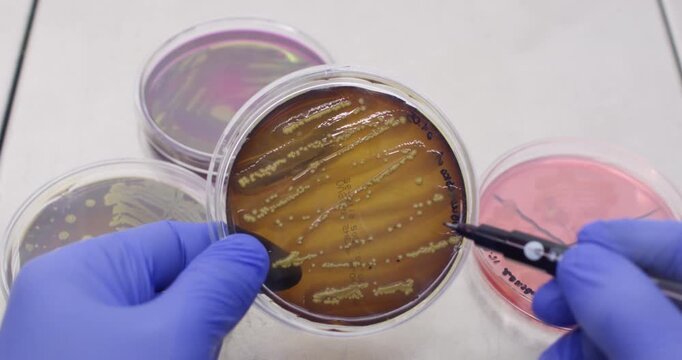 A scientist holds a petri dish with round colonies of bacteria inside and marks some of the colonies on the dish with a marker, putting dots.