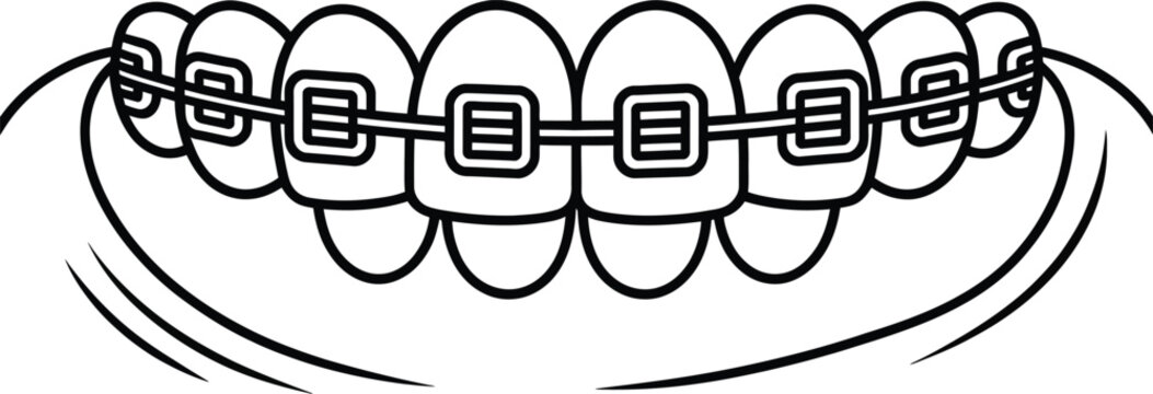 Orthodontic braces, dental brackets, teeth illustration, black and white vector