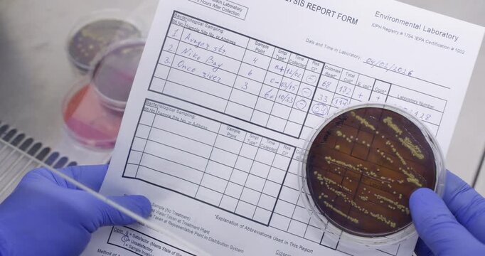 Analysis of experimental values ​​and indicators of bacterial cultures in a laboratory form and on a Petri dish in a microbiology laboratory.