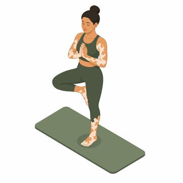 Isometric vector illustration of a young woman with vitiligo skin condition practicing yoga in tree pose on a green mat, wearing green sportswear, isolated on a white background.