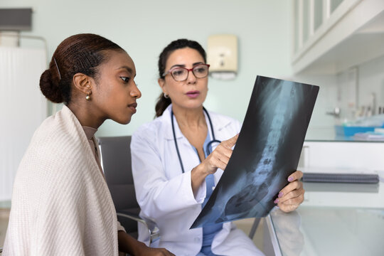 Senior doctor explaining spinal X-ray shot to female patient, showing imaging result, telling diagnosis. Young African American woman with back problems consulting trauma surgeon