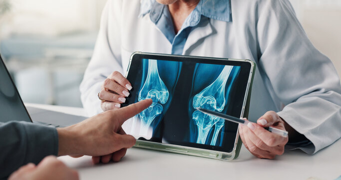 Tablet screen, doctor and patient hands with xray for knee injury, surgery planning or diagnosis. Health, people and tech with CT scan review for joint dislocation, assess damage and clinic follow up