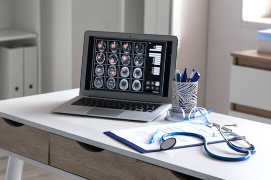 Medical brain scan results on laptop screen with stethoscope and clipboard on doctors desk, this setup represents modern healthcare technology and professional medical practice