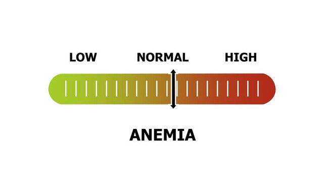 anemia level indicator scale. Low normal & high meter infographic animation. Showing high anemia level color gauge indicator. on a white background 4k animation video
