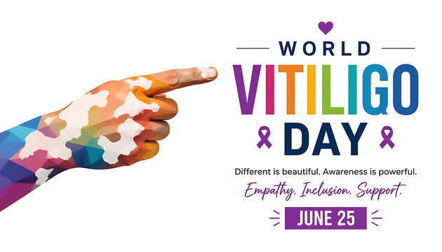 Colorful geometric hand pointing to World Vitiligo Day awareness poster with support message on June 25