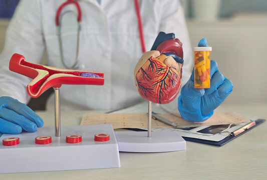 Doctor shows heart model and medication bottle during health consultation in a clinic setup