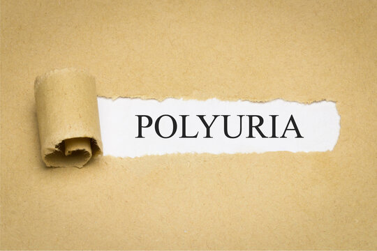 Polyuria