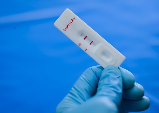 Blood sample of patient positive result for leishmania.