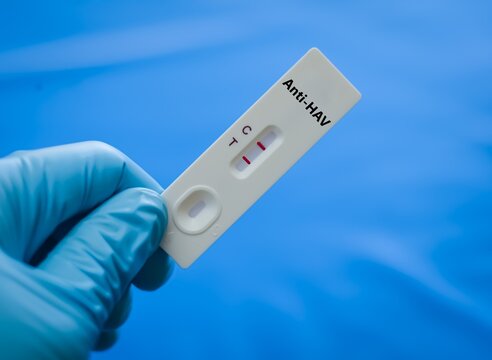 Blood sample of patient positive result for anti-HAV. 