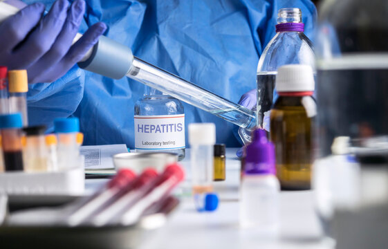 A scientist takes samples for hepatitis research in a laboratory, conceptual image