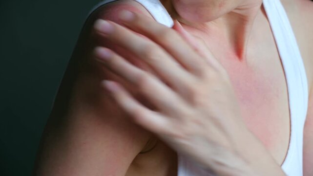Young woman touching painful sunburn on her shoulder, red irritated skin with visible damage. She feels pain from touch on burnt shoulder and chest area. Effects of sunburn on female body close up.