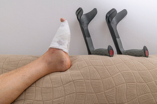 A bandaged foot after surgery to correct a bunion and two crutches leaning against the wall