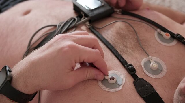 Medical professional attaching electrodes to a male patient's chest for a 24-hour electrocardiogram test to monitor heart activity, a crucial procedure in modern cardiology diagnostics