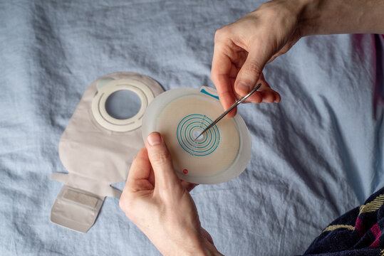 Ostomy bag and paste for fixing to the bed.
