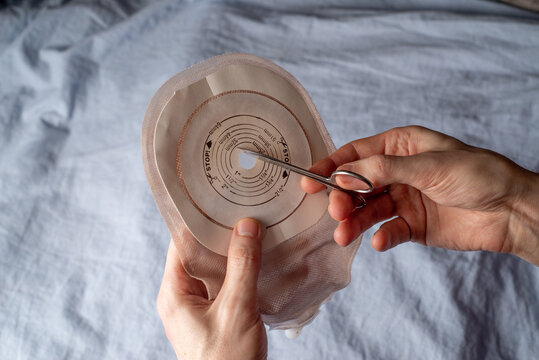 Ostomy bag and paste for fixing to the bed.