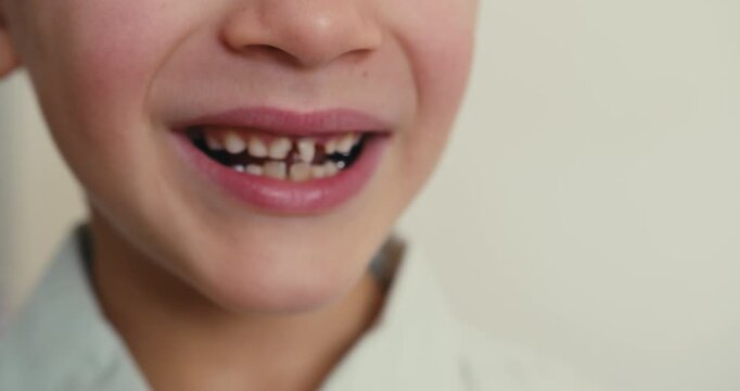 A close-up of a blond boy who smiles sincerely and touches his loose milk tooth with his pointer finger.