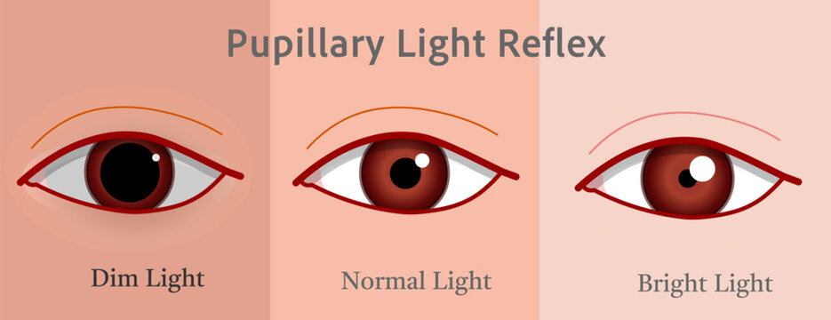 Pupillary light reflex eye, photopupillary. The brightness of the light reduces the size of the pupilBig pupil dim bright light, small iris. Illustration vector