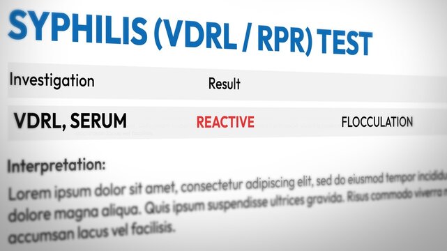 Reactive serum flocculation in syphilis test results with interpretation for medical diagnosis and healthcare analysis backdrop