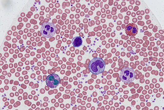 Microscopic observation of a stained human blood smear.