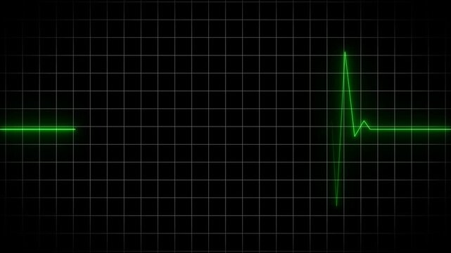 EKG Heart Monitoring Endless loop animation. Full HD. 4K