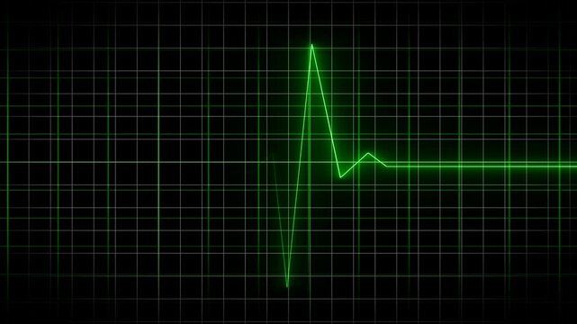 EKG Heart Monitoring Endless loop animation. Full HD. 4K