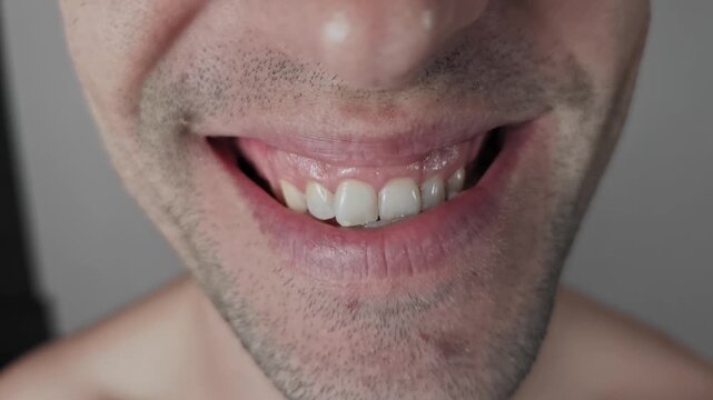Close-up shot captures an unshaven male mouth breaking into a wide genuine smile. The authentic expression reveals pink gums and a crooked incisor against a neutral backdrop.