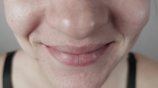Macro front view shows a female lower face with natural freckles forming a subtle smirk. The pink lips curve into a gentle smile while dimples form on the cheeks.
