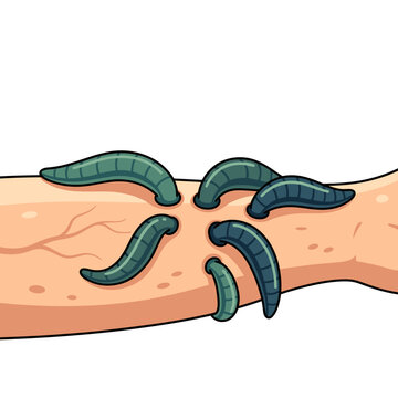 Close-up of medical leeches on skin with realistic details  
