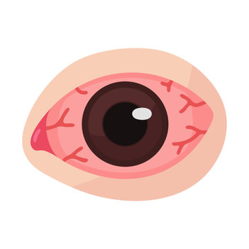 Vibrant vector illustration of a red, irritated human eye, showing visible blood vessels, symbolizing discomfort and inflammation
