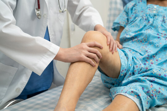 Doctor checking Asian elderly woman patient knee replacement surgery in hospital.