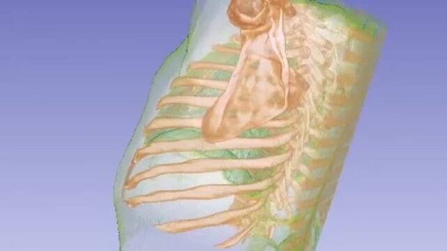 Volumetric 3D Model Render of Midface and Nasal Skeleton for Craniofacial Preoperative Navigation