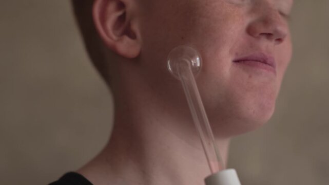 A teenager uses a Darsonval device on their face. Professional skincare at home. Teenage skin problems during hormonal changes. High quality FullHD footage