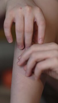 A teenager covers a granulation on his lower leg with an adhesive plaster. High quality FullHD footage