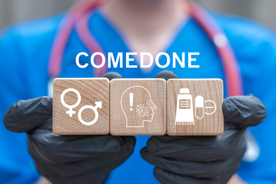 Concept of comedones. Whiteheads, closed comedone, acne skin disease treatment.
