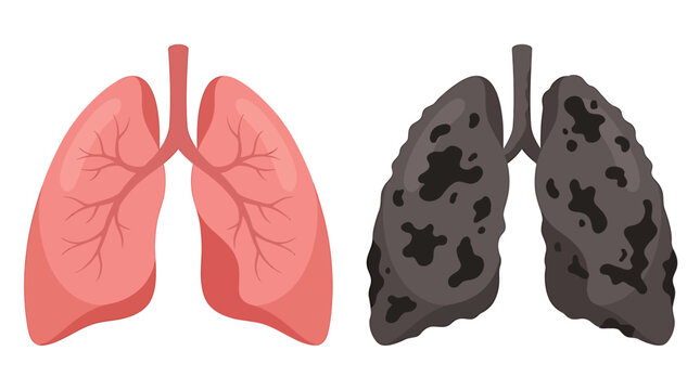 Dark Gray Damaged Smokers Lung Anatomy Icon
