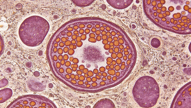 Microscopic images of human mast cells, granular structure, immunological research photography.