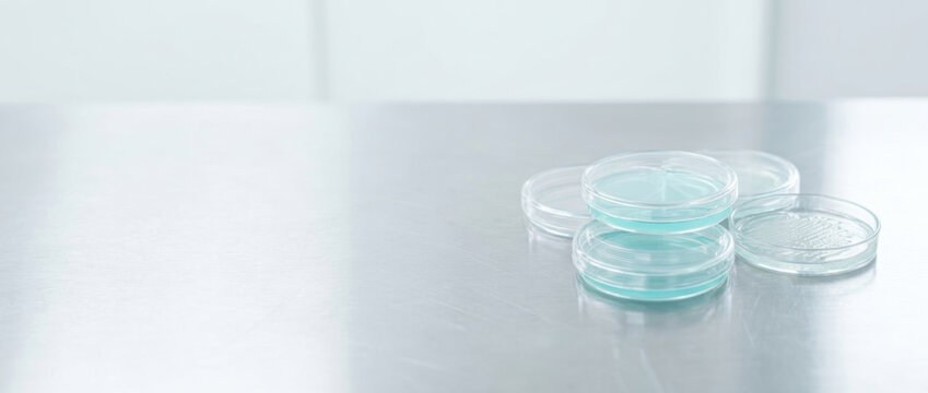 Petri dish with blue culture on stainless lab bench, sterile clinical setting