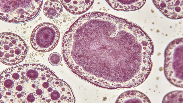 Micrograph of human monocyte leukocytes, large irregular nucleus structure, immunology research photography