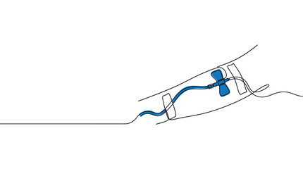 Fototapeta premium Continuous line drawing depicts a blue butterfly needle inserted into an arm, illustrating medical procedures on a clean white background