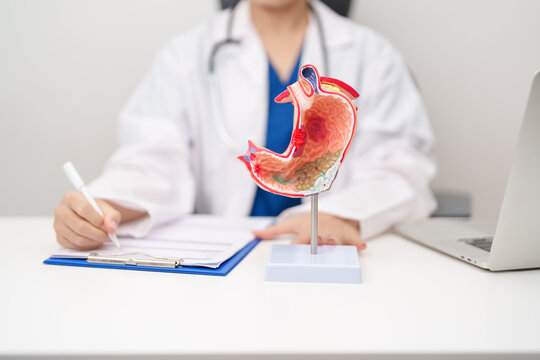 Doctor with Gastric anatomy model. Gastroenterologist consultation, stomach diseases and ulcers, November stomach cancer, Gastroesophageal Reflux Disease, GERD, Acid reflux and healthcare medical