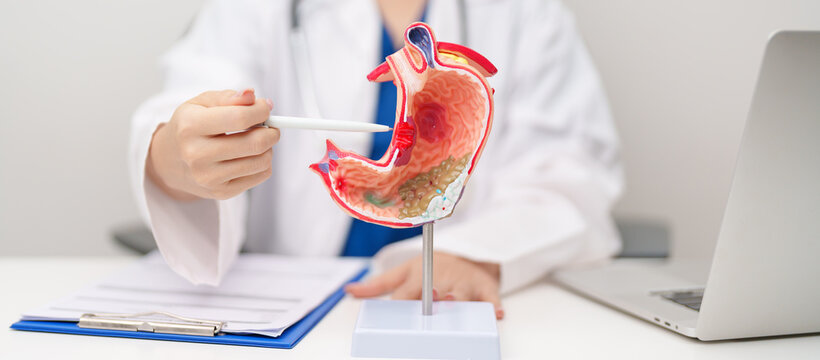 Doctor with Gastric anatomy model. Gastroenterologist consultation, stomach diseases and ulcers, November stomach cancer, Gastroesophageal Reflux Disease, GERD, Acid reflux and healthcare medical