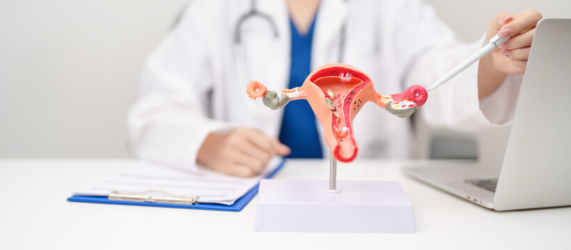 Doctor with Uterus and Ovaries anatomy model. Ovarian and Cervical cancer, Cervix disorder, Endometriosis, Hysterectomy, Uterine fibroids, Reproductive system, Pregnancy and health concept