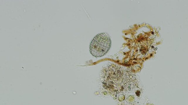 Coleps protozoan at 20x under brightfield microscopy