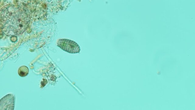 Coleps ciliate at 20x under Nomarski DIC microscopy