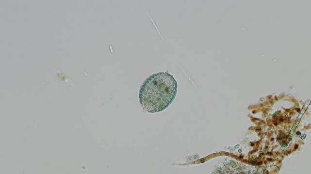 Coleps protist at 20x under Nomarski DIC microscopy