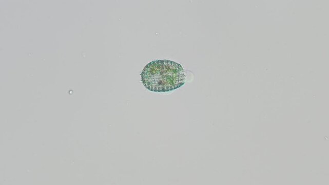 Coleps ciliate detail at 20x under Nomarski DIC