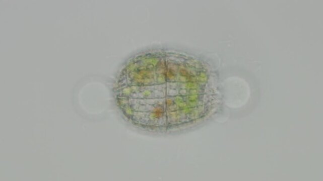 Coleps protozoan close-up at 50x under brightfield